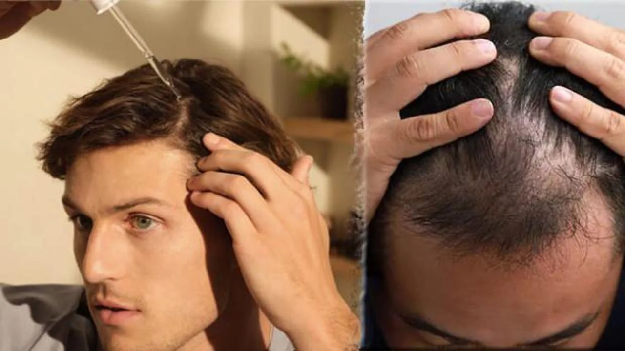 Saç Dökülmesi Nedenleri ve Çözümleri